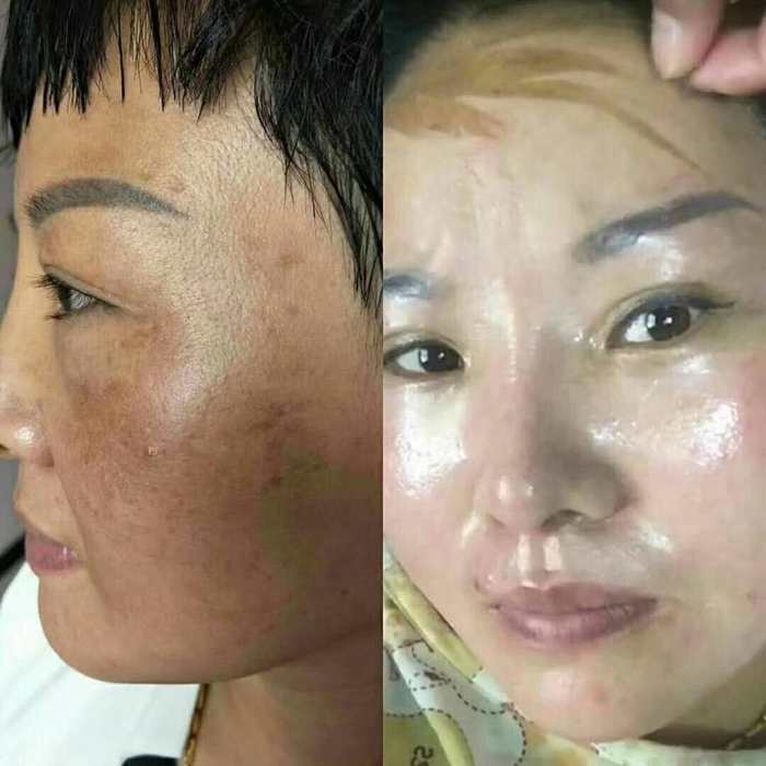 一次性祛斑【阿城供求世界】 - 在线看报 - 免费发布信息 - 高效,快捷